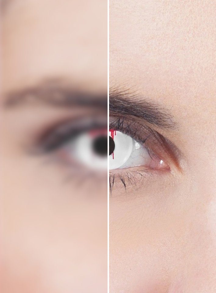 Metamorph Motivlinsen Blutendes Auge weiß mit Dioptrien, Eine farbige Kontaktlinse mit Stärke