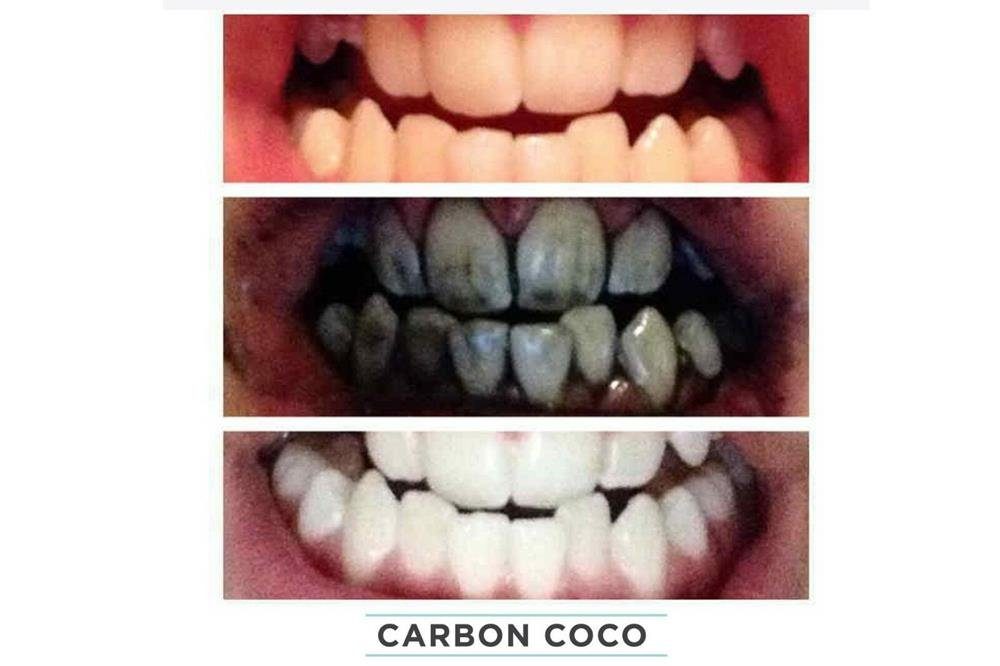 Haushalt Zahnpflege MAVURA Zahnbleaching-Pulver Carbon Coco Kokosnuss Aktivkohle Pulver Zahnaufhellung Zahnpolitur Zahnweiß Zahn