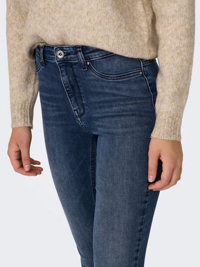 ONLY Skinny-fit-Jeans FOREVER (1-tlg) Plain/ohne Details
