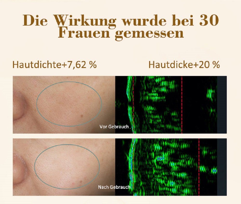COOL-i ® Mikrodermabrasionsgerät RF & EMS Gesichtsgerät – 2 Modi & 3 Intensitätsstufen, Sanfte Hautpflege mit EMS & Licht – kabellos & benutzerfreundlich