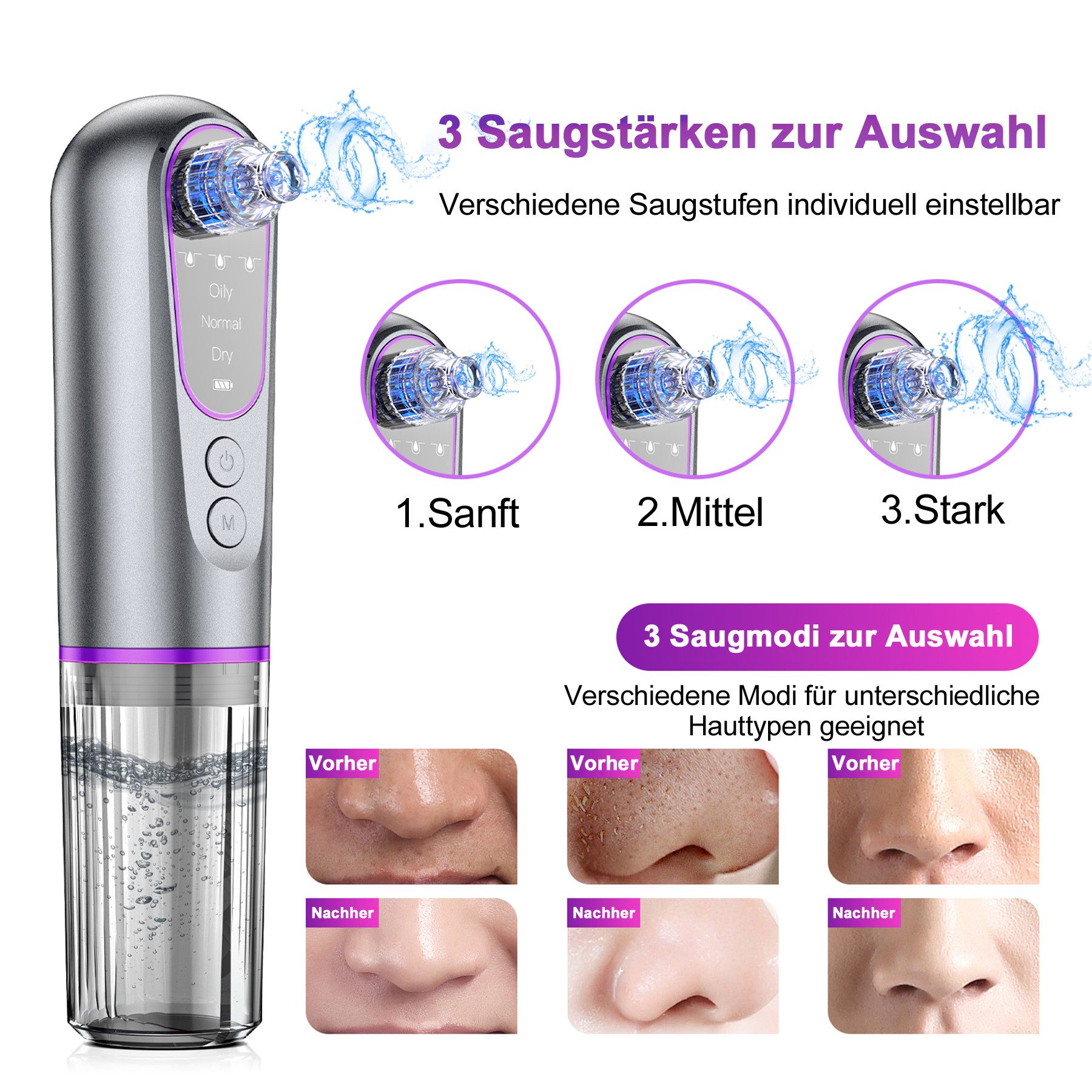 Senmudi Porenreiniger Mitesserentferner Porensauger Gesicht, Elektrischer Porenreiniger mit 5 Saugköpfen und 3 Reinigungsstufen, Mitesser Entfernung Porensauger Mitesser Sauger Elektrisch, für Gesichtsreinigung und Hautpflege