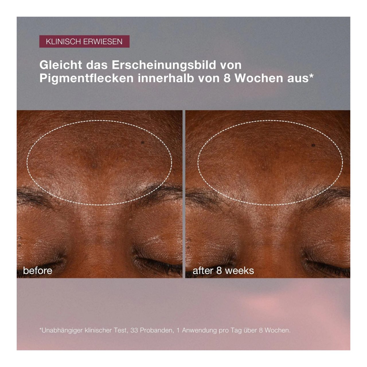 Dermalogica Gesichtspflege Age Smart Dynamic Skin Recovery SPF 50, für Alle Hauttypen